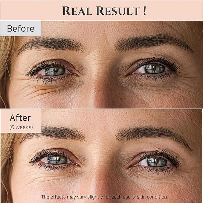 Beauty of Joseon Revive Eye Serum + Retinol